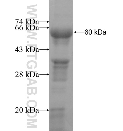 AK7 fusion protein Ag11152 SDS-PAGE AK7 fusion protein Ag11152 SDS-PAGE