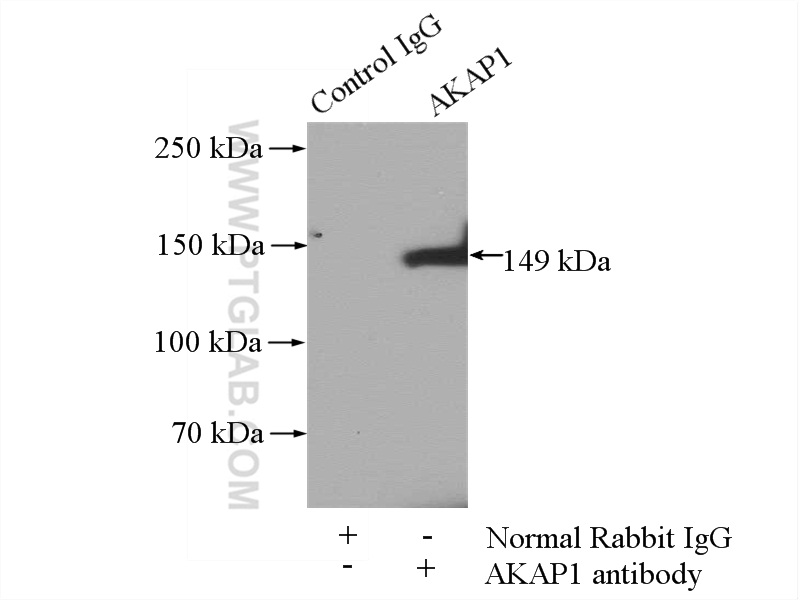 IP experiment of PC-3 using 15618-1-AP