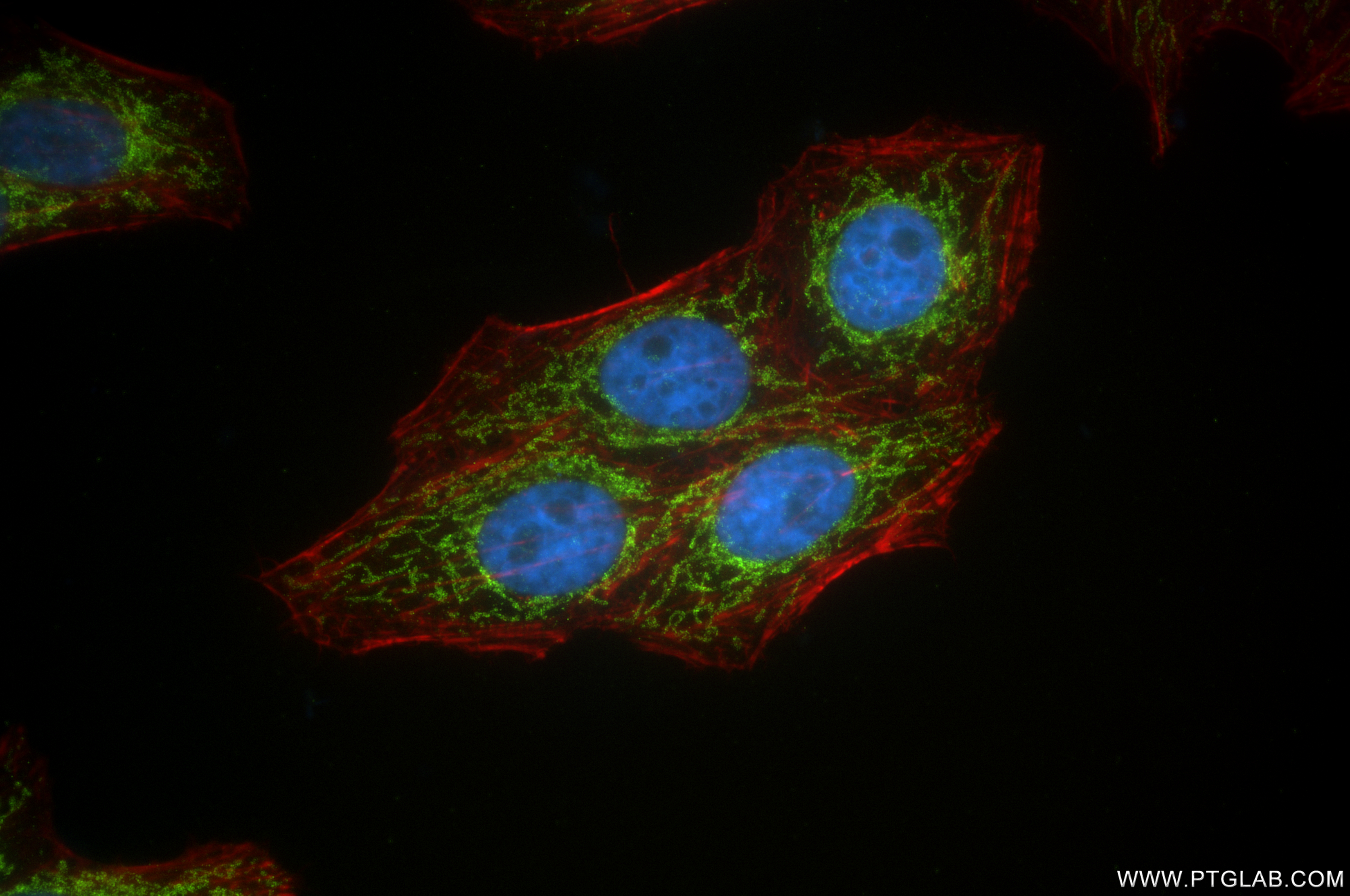 IF Staining of HepG2 using 85119-2-RR (same clone as 85119-2-PBS)