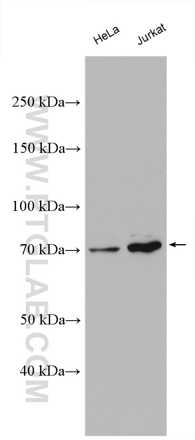 WB analysis using 12356-1-AP