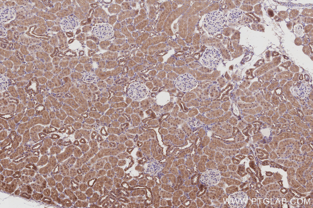 IHC staining of rat kidney using 30552-1-AP IHC staining of rat kidney using 30552-1-AP