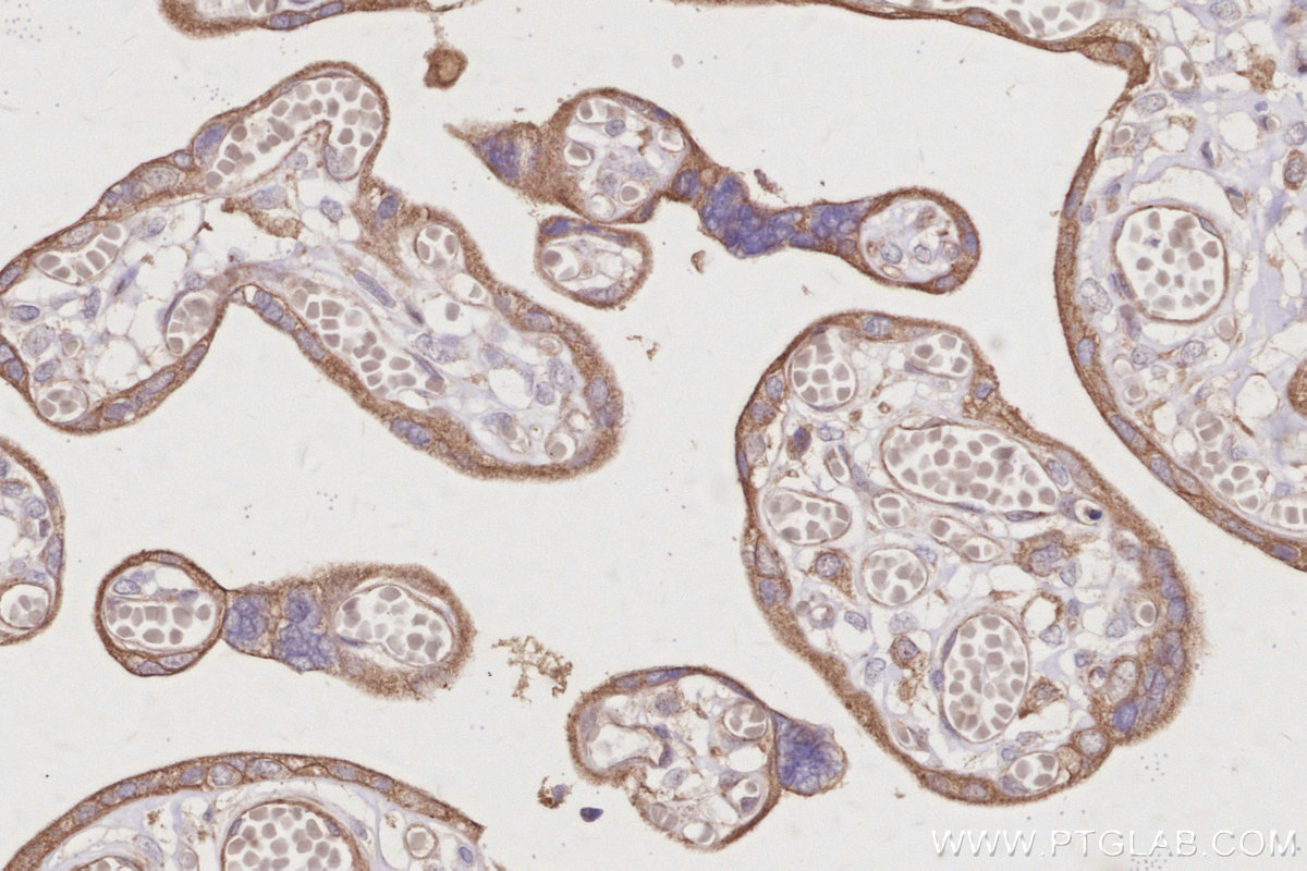 IHC staining of human placenta using 30552-1-AP IHC staining of human placenta using 30552-1-AP
