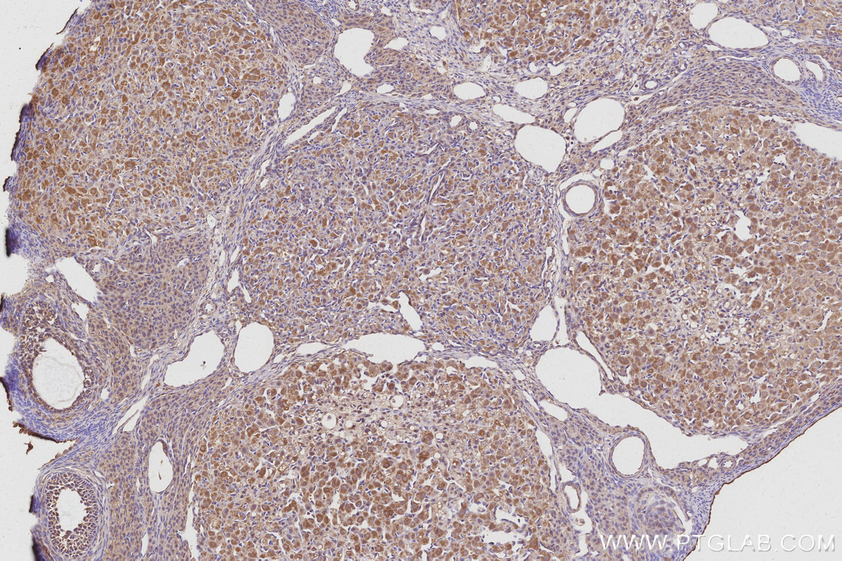 IHC staining of rat ovary using 30552-1-AP IHC staining of rat ovary using 30552-1-AP