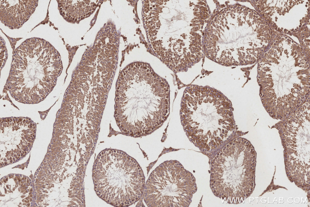 IHC staining of rat testis using 30552-1-AP IHC staining of rat testis using 30552-1-AP