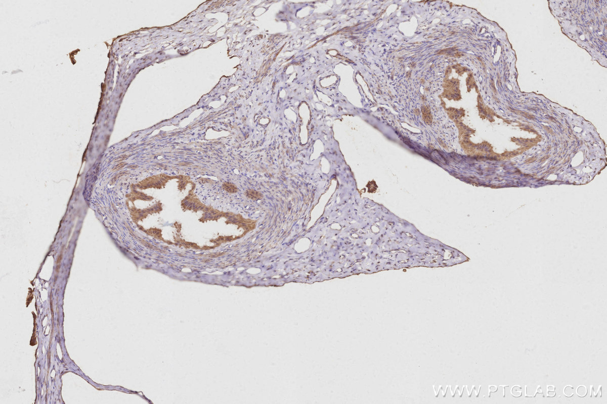 IHC staining of rat ovary using 30552-1-AP IHC staining of rat ovary using 30552-1-AP