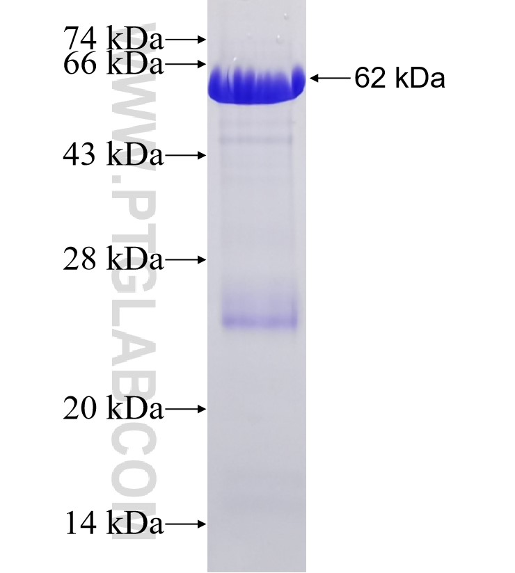 AKAP12 fusion protein Ag32851 SDS-PAGE