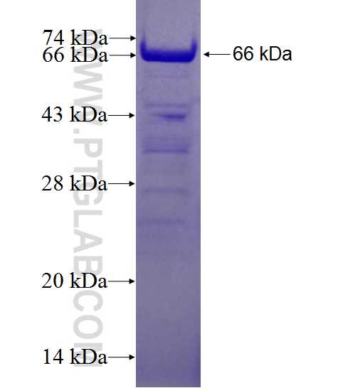 AKAP13 fusion protein Ag27486 SDS-PAGE