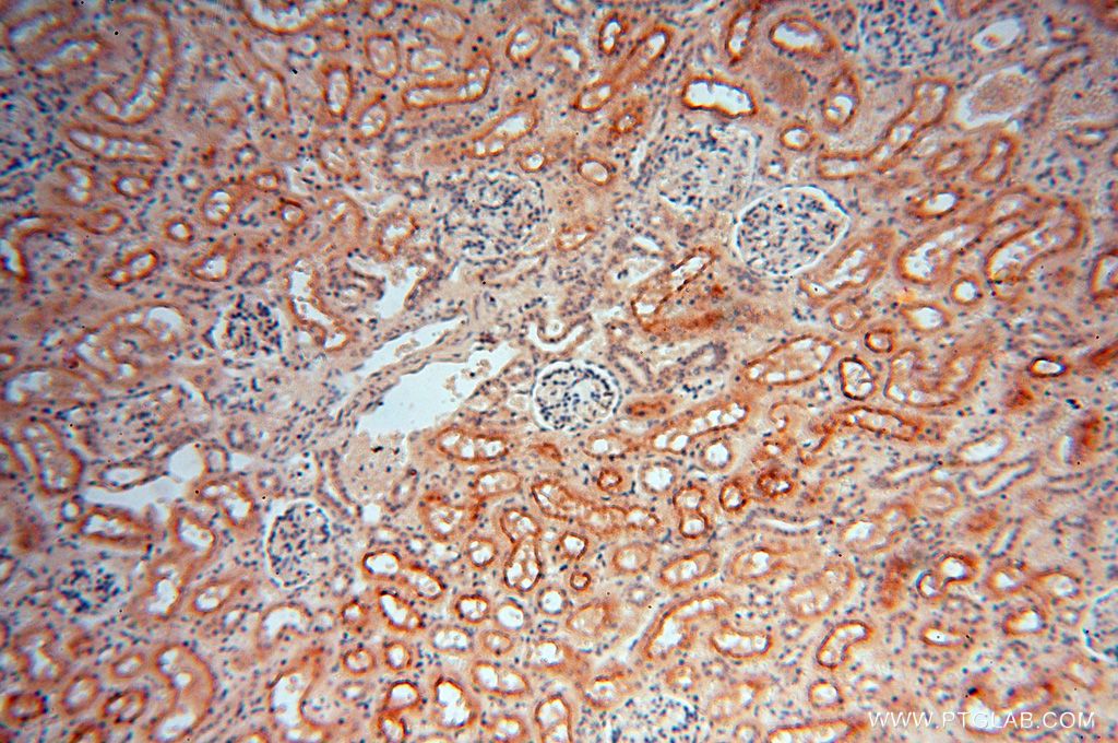 IHC staining of human kidney using 14622-1-AP