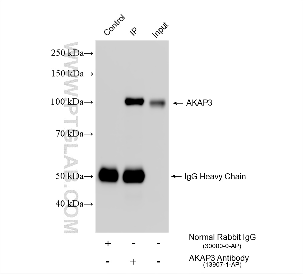 IP experiment of mouse testis using 13907-1-AP IP experiment of mouse testis using 13907-1-AP