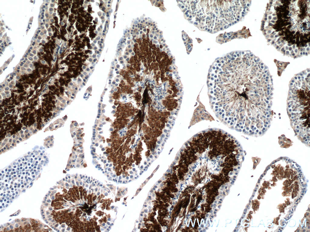 IHC staining of mouse testis using 66255-1-Ig