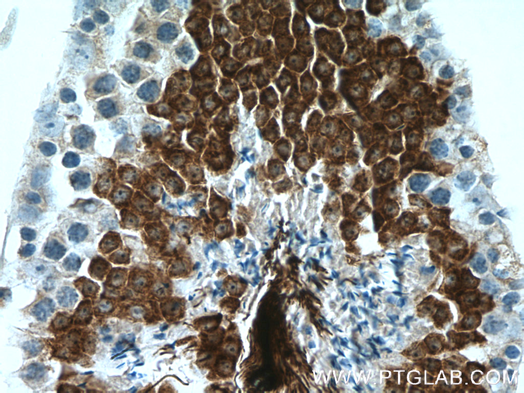 IHC staining of mouse testis using 66255-1-Ig