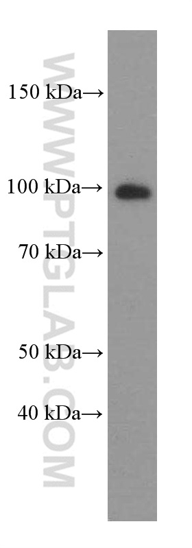 WB analysis of human testis using 66255-1-Ig