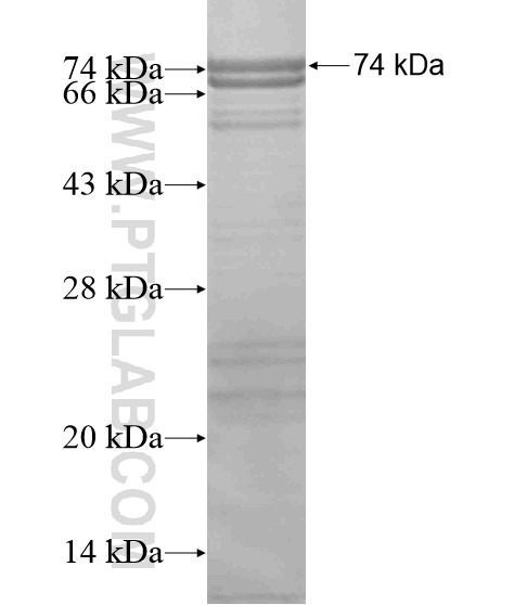 AKAP5 fusion protein Ag19162 SDS-PAGE AKAP5 fusion protein Ag19162 SDS-PAGE
