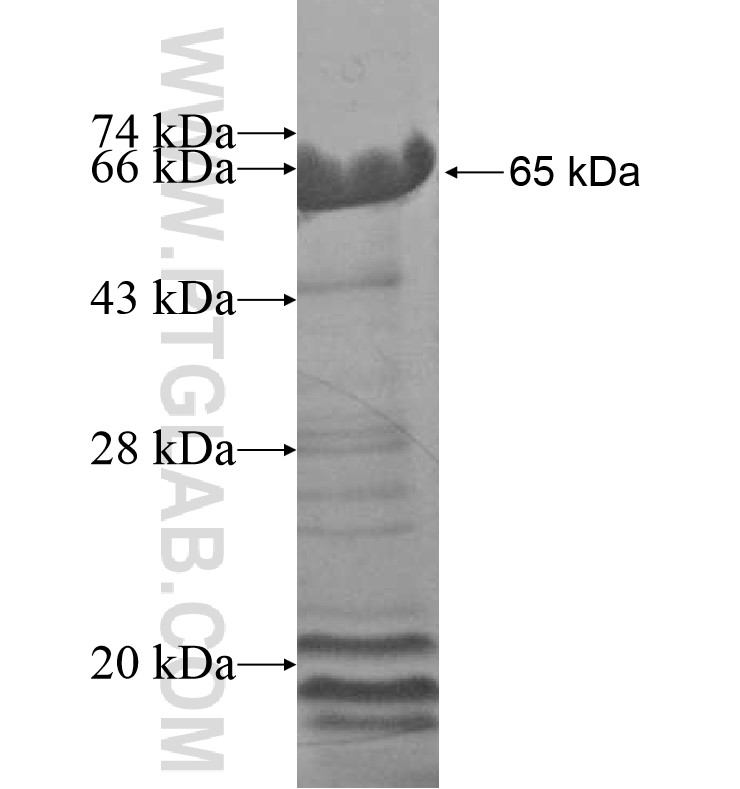 AKAP6 fusion protein Ag16181 SDS-PAGE AKAP6 fusion protein Ag16181 SDS-PAGE
