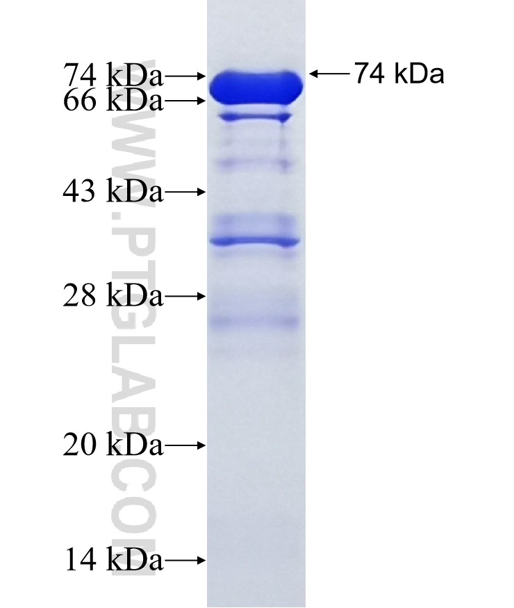AKAP6 fusion protein Ag15749 SDS-PAGE