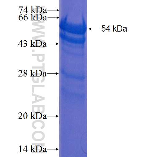 AKAP8L fusion protein Ag0145 SDS-PAGE