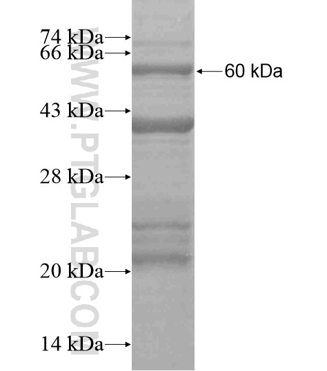 AKD1 fusion protein Ag19154 SDS-PAGE AKD1 fusion protein Ag19154 SDS-PAGE
