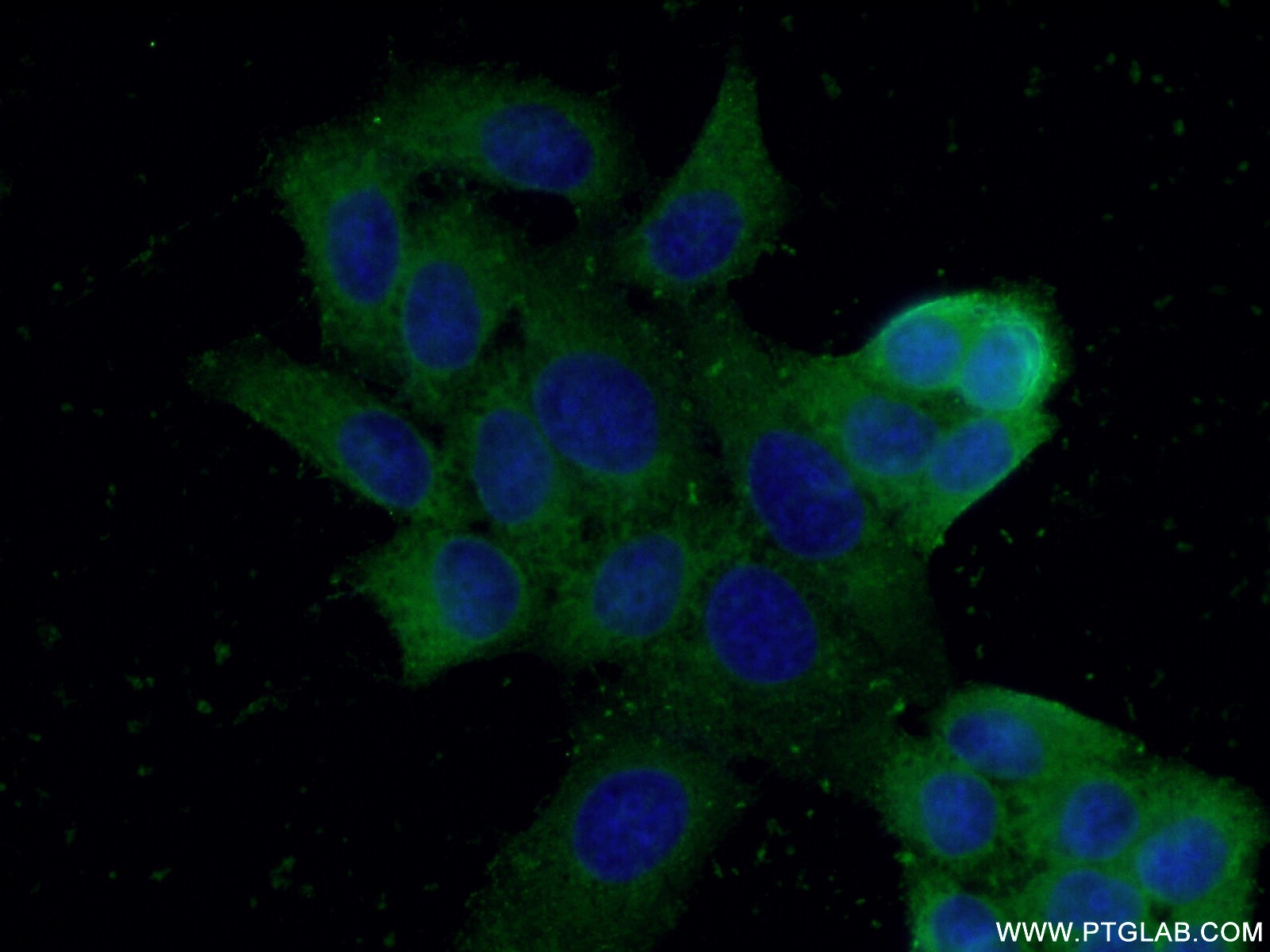 IF Staining of HeLa using 15054-1-AP
