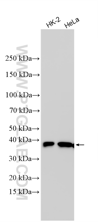 WB analysis using 15054-1-AP