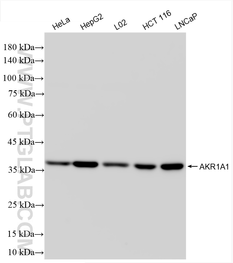 WB analysis using 86147-1-RR (same clone as 86147-1-PBS)