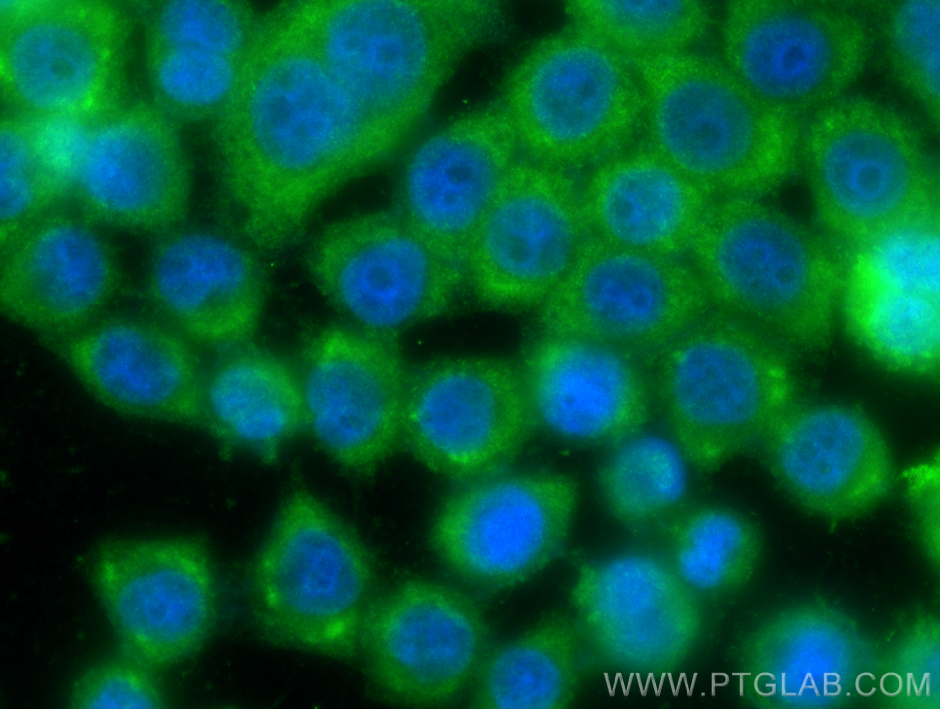 IF Staining of BxPC-3 using 15439-1-AP (same clone as 15439-1-PBS)