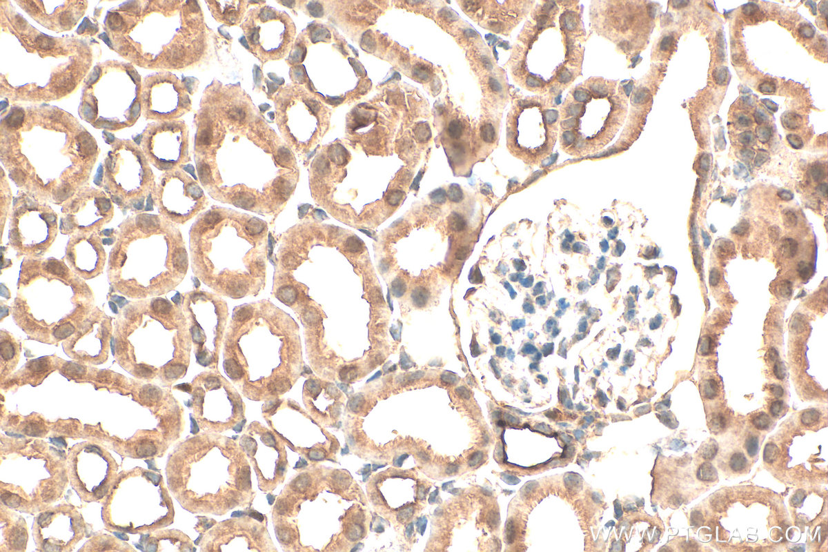 Immunohistochemical analysis of paraffin-embedded mouse kidney tissue slide using 15439-1-AP (AKR1B1 antibody) at dilution of 1:200 (under 40x lens). Heat mediated antigen retrieval with Tris-EDTA buffer (pH 9.0). IHC staining of mouse kidney using 15439-1-AP