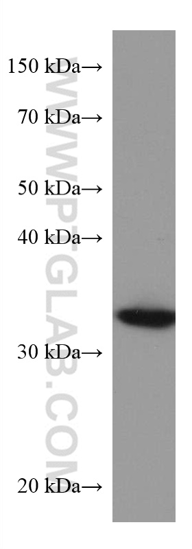 WB analysis of HeLa using 67498-1-Ig (same clone as 67498-1-PBS)
