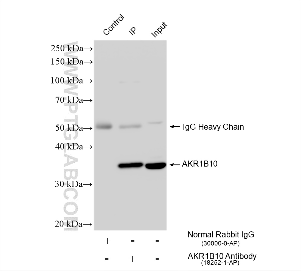 IP result of anti-AKR1B10 (IP:18252-1-AP, 4ug; Detection:18252-1-AP 1:4000) with HepG2 cells lysate 2000 ug. IP experiment of HepG2 using 18252-1-AP