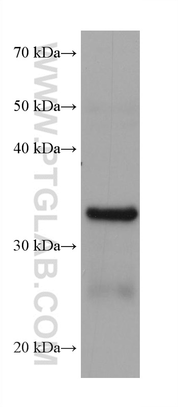 WB analysis of rat stomach using 68327-1-Ig