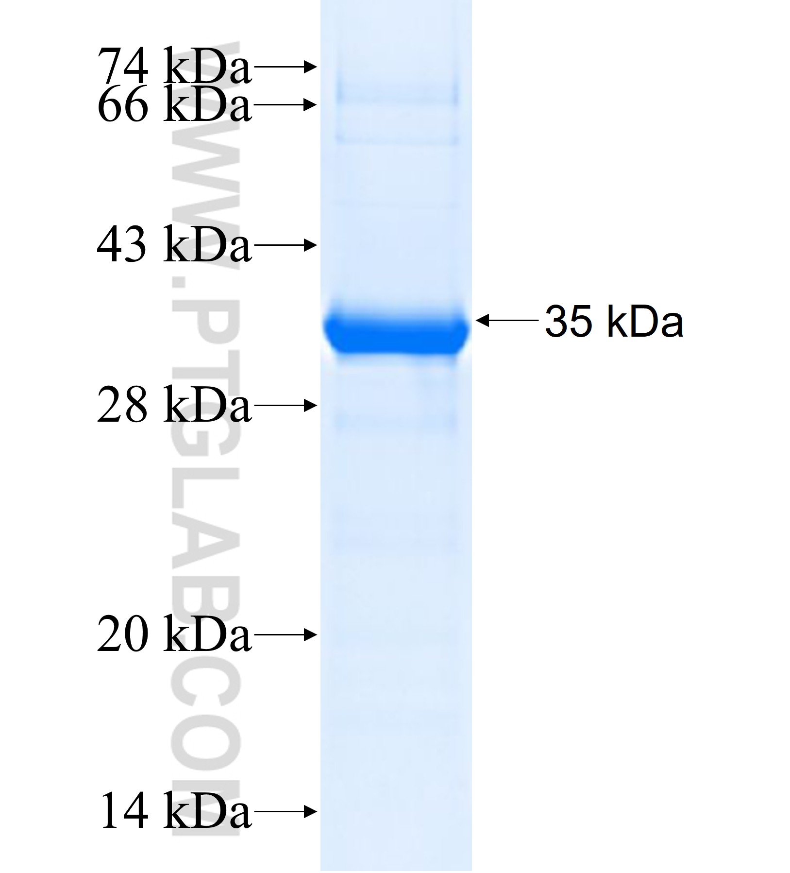 AKR1C1 fusion protein Ag37626 SDS-PAGE AKR1C1 fusion protein Ag37626 SDS-PAGE