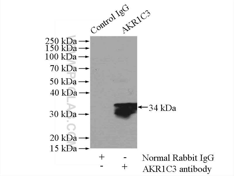 IP experiment of HepG2 using 11194-1-AP