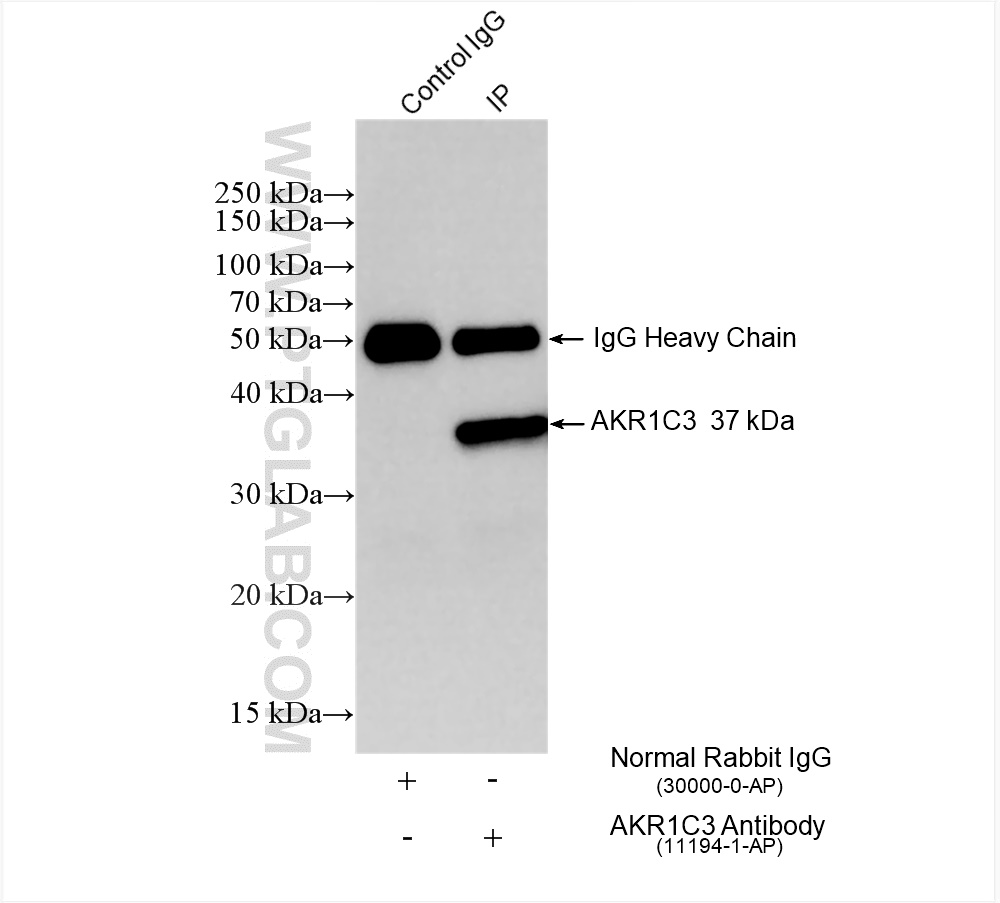 IP experiment of HepG2 using 11194-1-AP