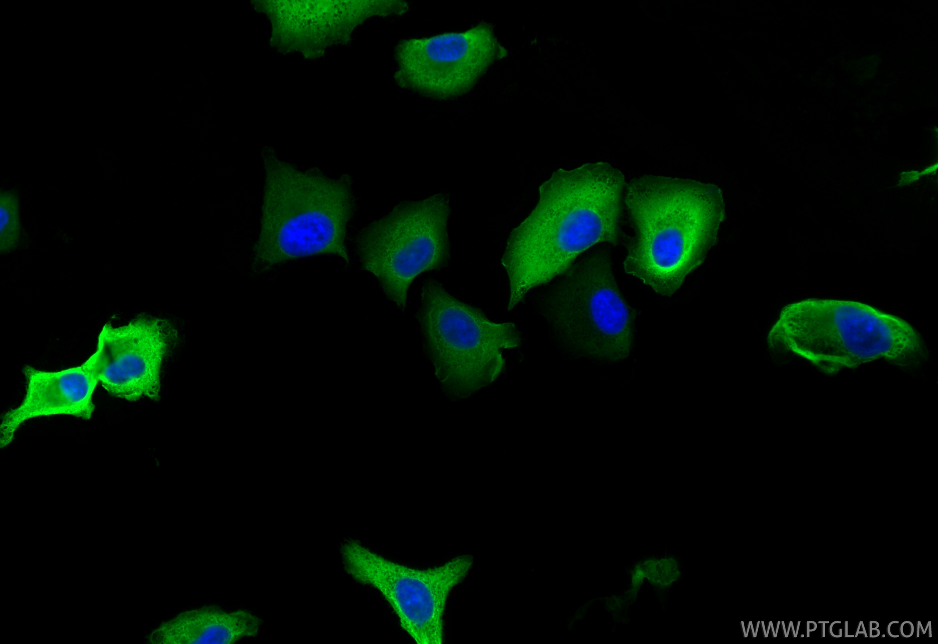 IF Staining of A549 using RMX00069