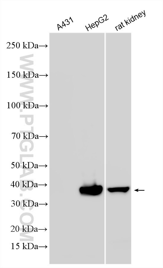 WB analysis using RMX00069