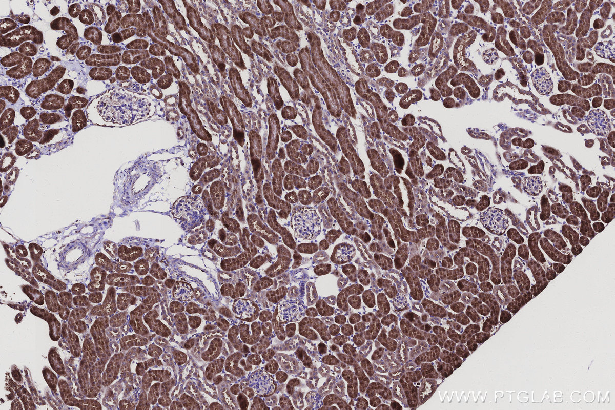 IHC staining of mouse kidney using 10730-1-AP IHC staining of mouse kidney using 10730-1-AP