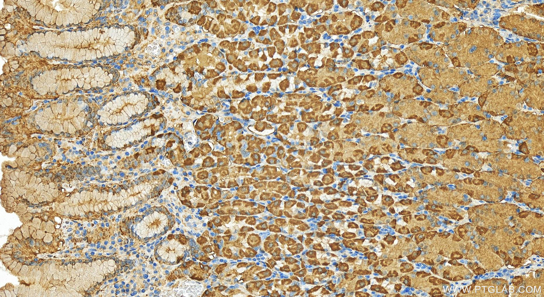 IHC staining of human stomach using 13209-1-AP