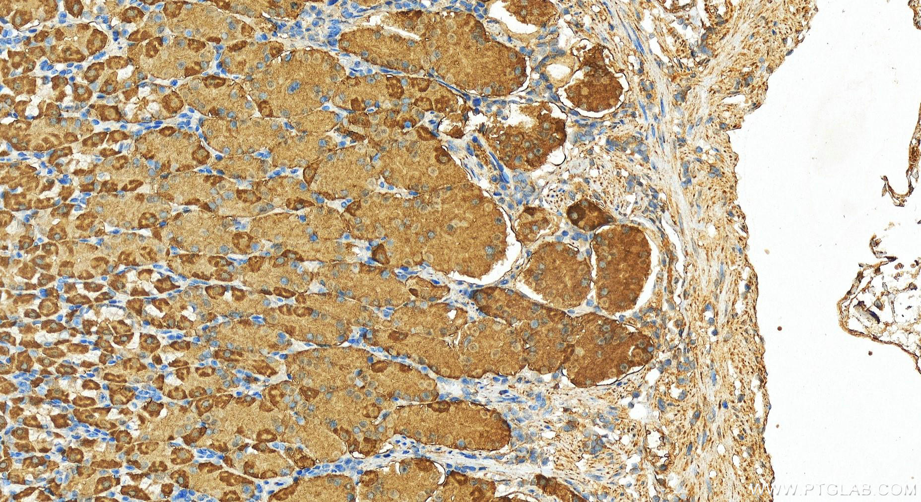 IHC staining of human stomach using 13209-1-AP