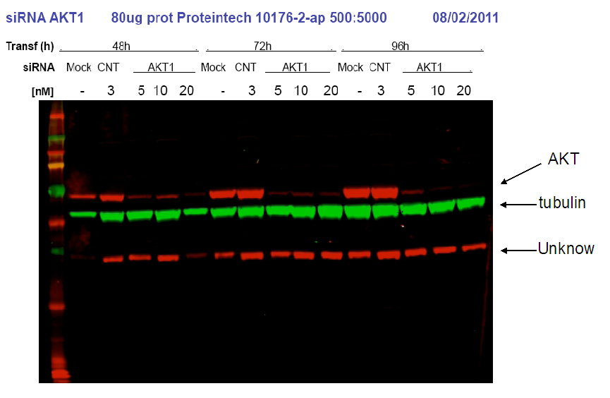 AKT Polyclonal antibody