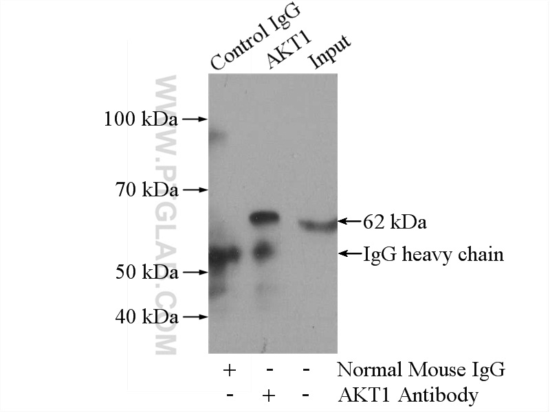 IP experiment of mouse brain using 60203-1-Ig