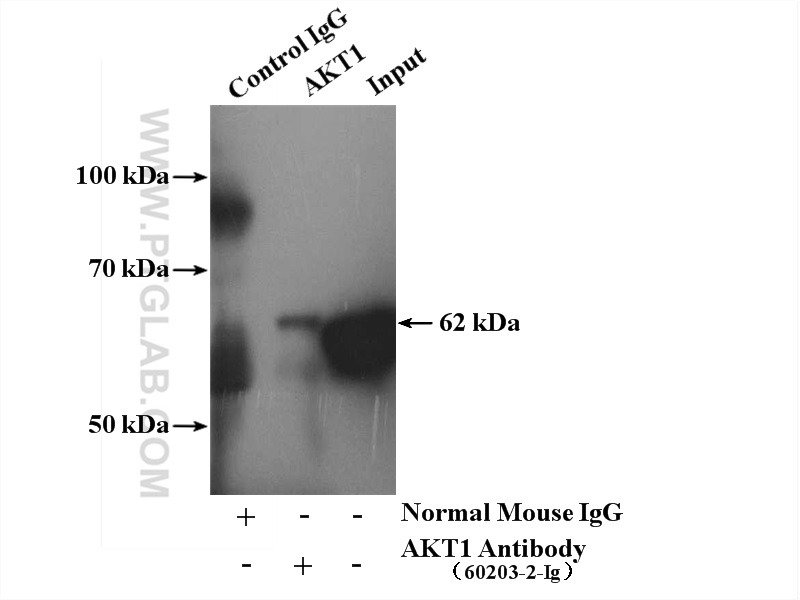 IP experiment of mouse brain using 60203-2-Ig (same clone as 60203-2-PBS)