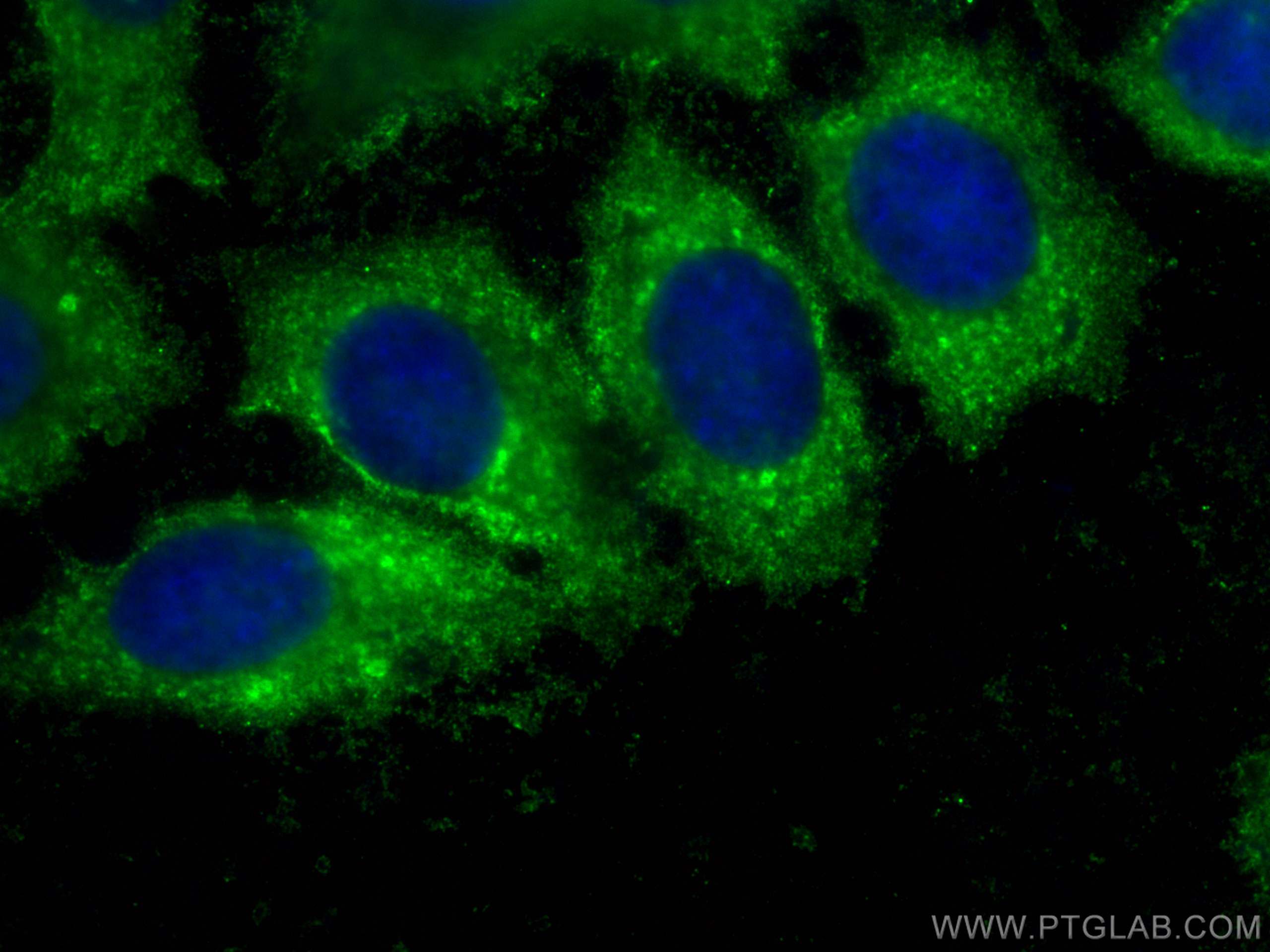 IF Staining of MCF-7 using CL488-60203