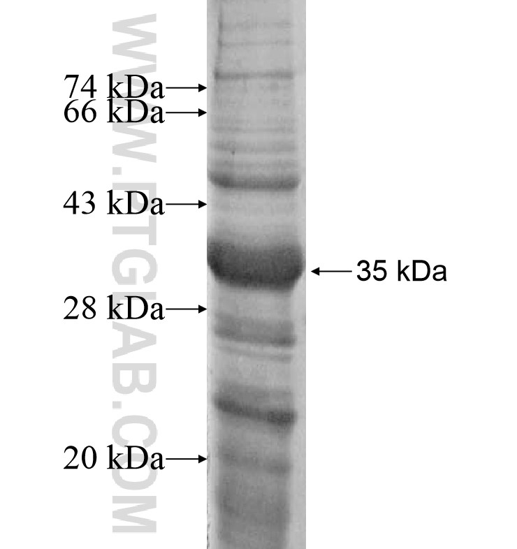 AKT fusion protein Ag16695 SDS-PAGE