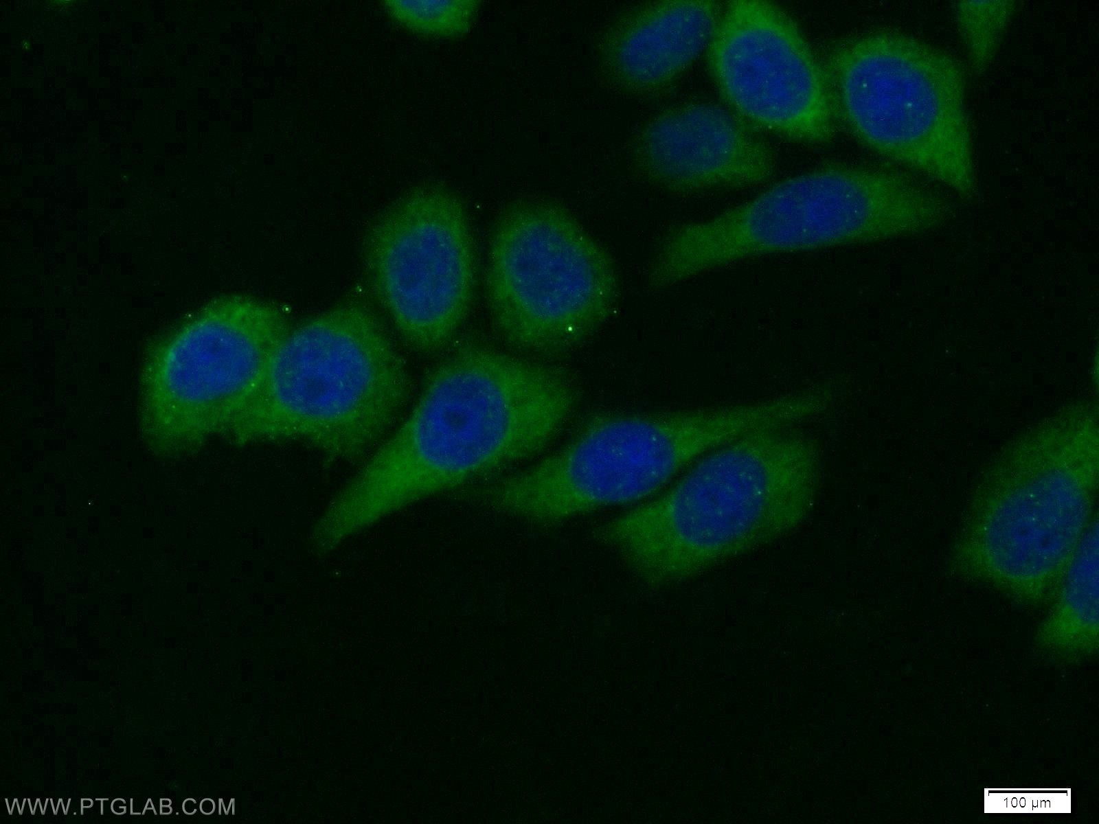 IF Staining of HeLa using 51077-1-AP
