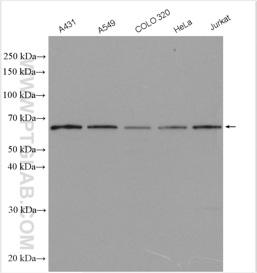 WB analysis using 51077-1-AP