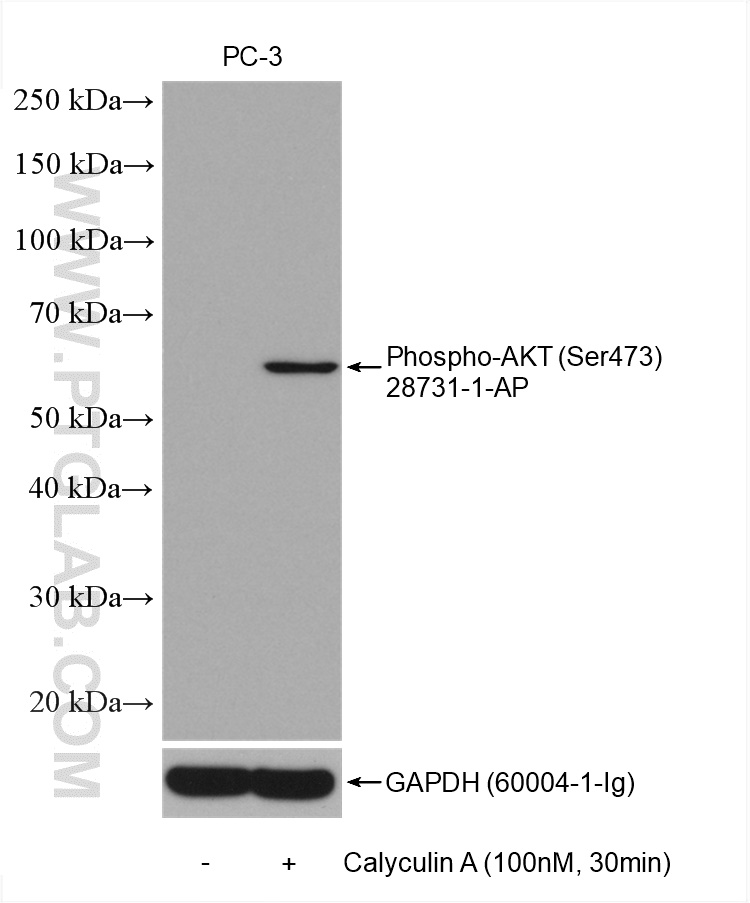 Phospho-AKT (Ser473)