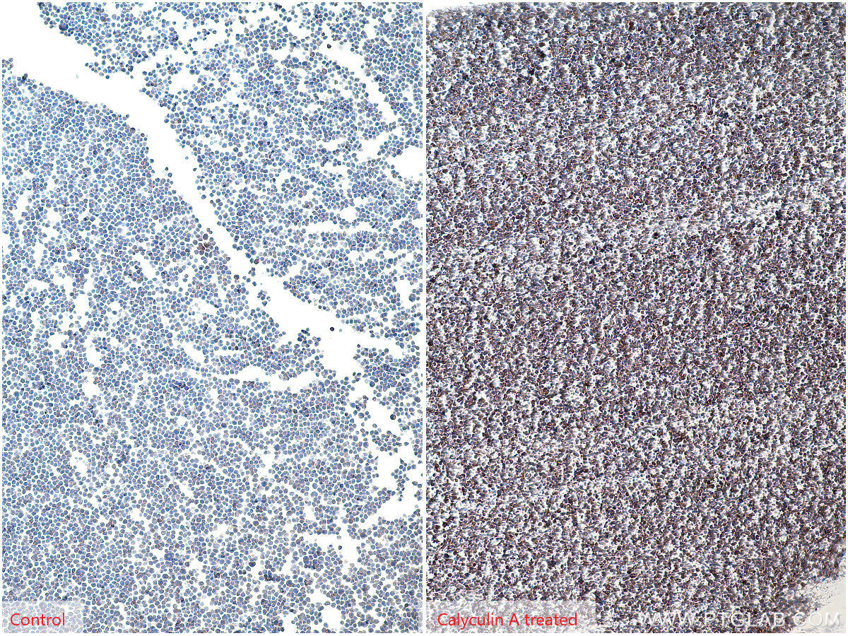 IHC staining of Jurkat using 66444-1-Ig (same clone as 66444-1-PBS)