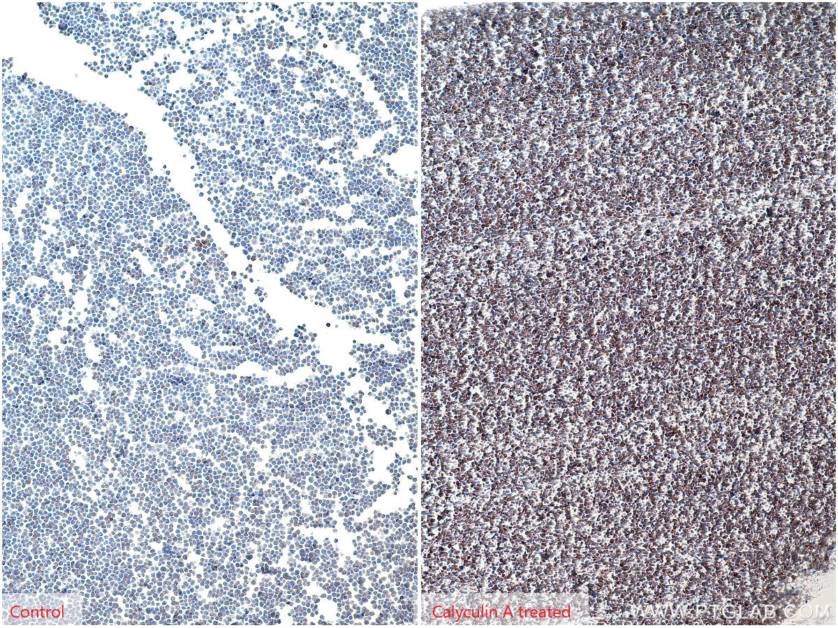 IHC staining of Jurkat using 66444-1-Ig