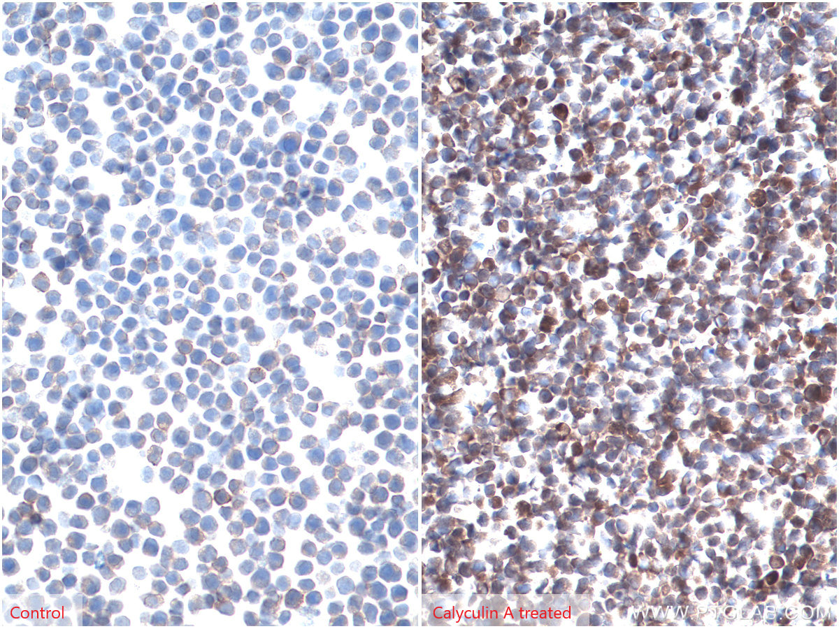 IHC staining of Jurkat using 66444-1-Ig (same clone as 66444-1-PBS)