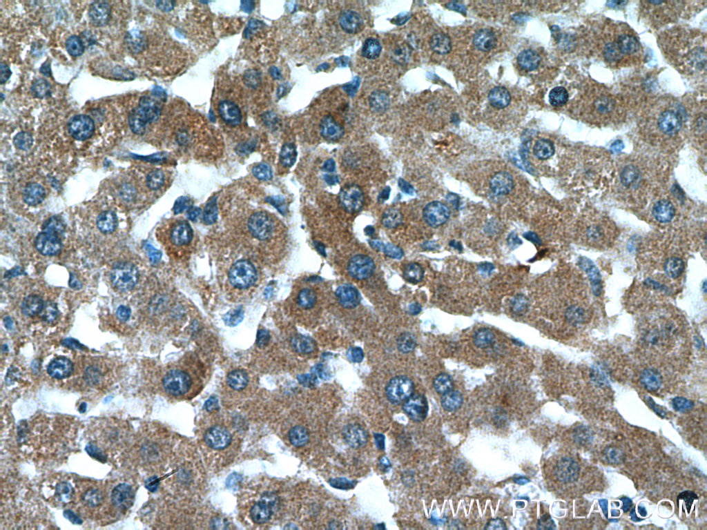 AKT2 Polyclonal antibody