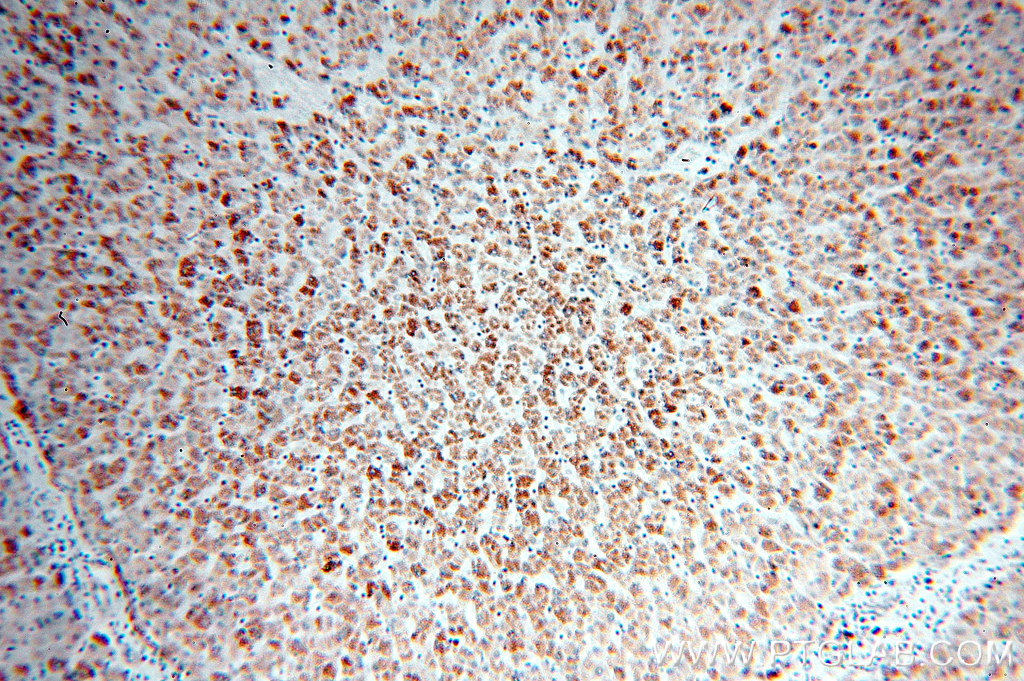 AKT2 Polyclonal antibody